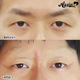 ASSISTWIG 눈썹지우기 장인AS 10g 썸네일 2