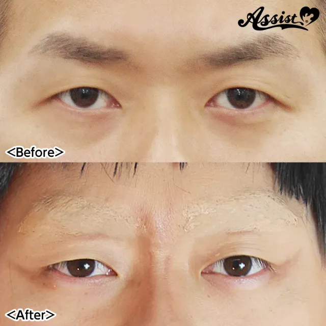 ASSISTWIG 눈썹지우기 장인AS 10g (ASSISTWIG) 제품 2번째 사진