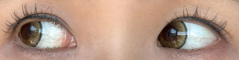 GAL NEVER DIE 갸루 네버 다이 1Month 이츠온미 착용 이미지
