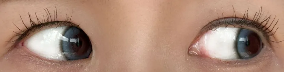 1day Refrear 실리콘하이드로겔 a-eye 에이아이 넥스트블루 렌즈착용 이미지