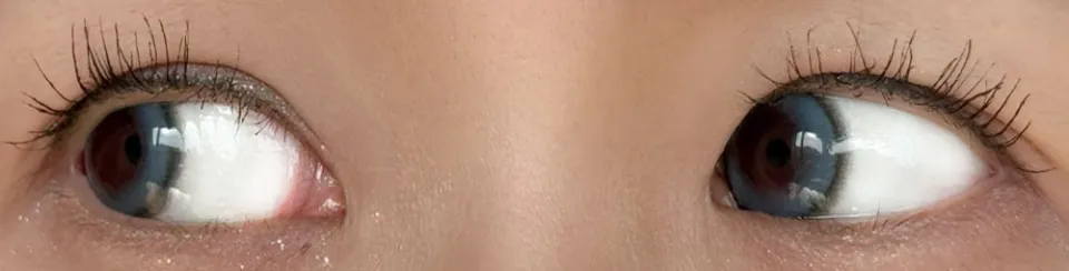 1day Refrear 실리콘하이드로겔 a-eye 에이아이 넥스트블루 렌즈착용 이미지