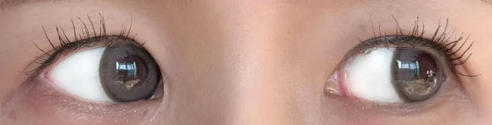 1day Refrear 실리콘하이드로겔 a-eye 에이아이 노바그레쥬 렌즈착용 이미지